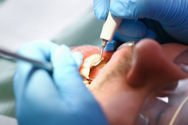 Best Emergency Dental Care for Sports Injuries in Lake Helen, FL